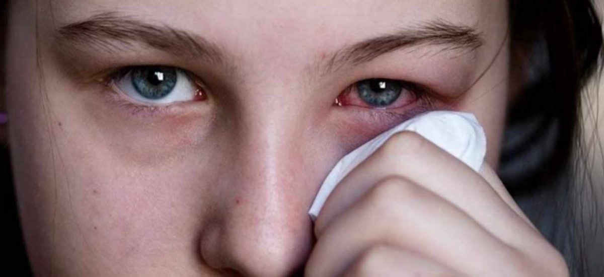 Schools shut down with conjunctivitis outbreak